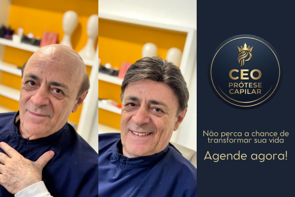 Antes e depois