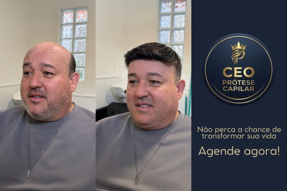 Antes e depois