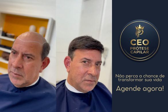 Antes e depois