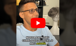 Depoimento de um cliente satisfeito com sua nova prótese capilar da Ceo Prótese Capilar